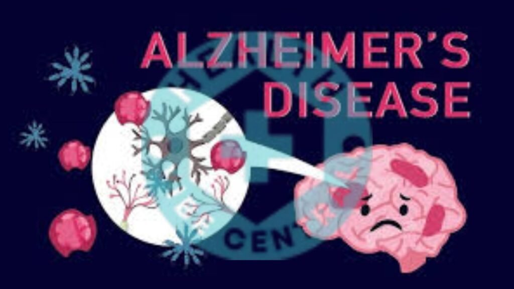 Alzheimer's Early Symptoms