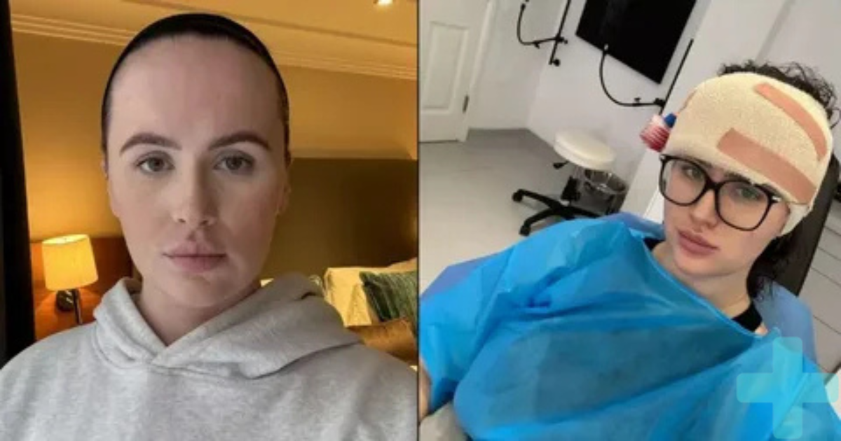Forehead Reduction Surgery